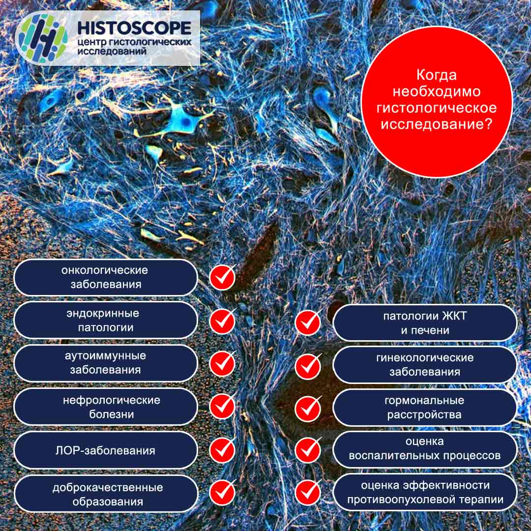 Когда НЕОБХОДИМО гистологическое исследование?